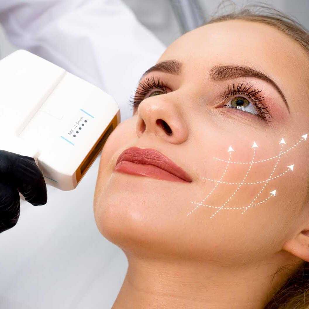 How HIFU Actually Tightens Your Skin